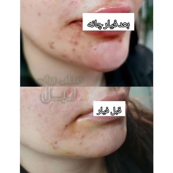 1710145131269.webp