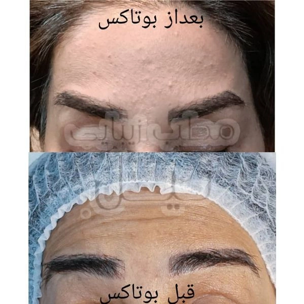 1710144514988.webp