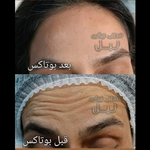 1710144806718.webp
