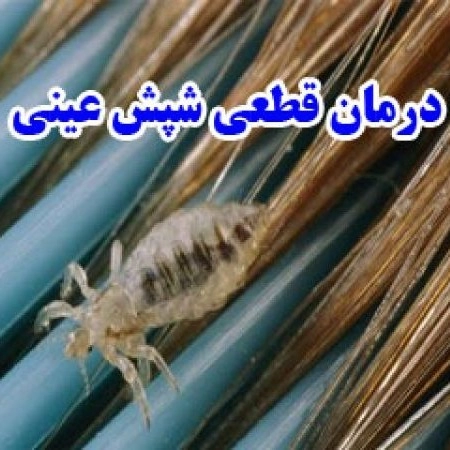 Definitive treatment of head lice in Tehran